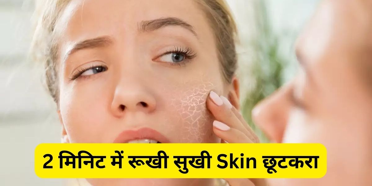 Home Remedies for Dry Skin