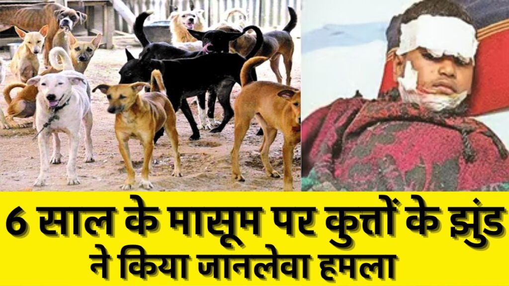 Stray Dogs: सड़क पर आवारा कुत्तों का आतंक! आंध्रप्रदेश में 6 साल के मासूम पर कुत्तों के झुंड ने किया जानलेवा हमला