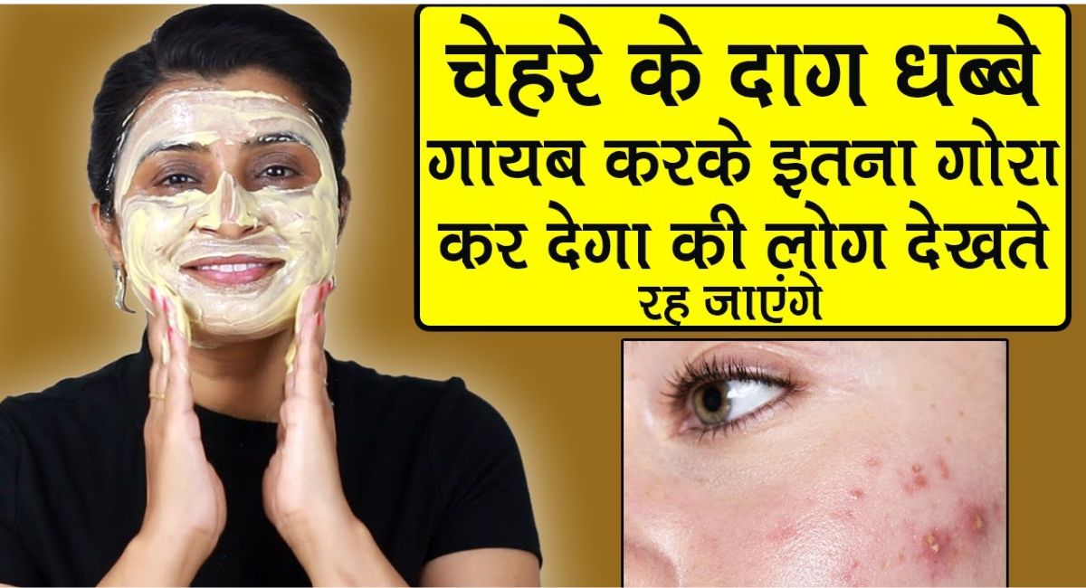 chehre ke kale dag kaise hataye