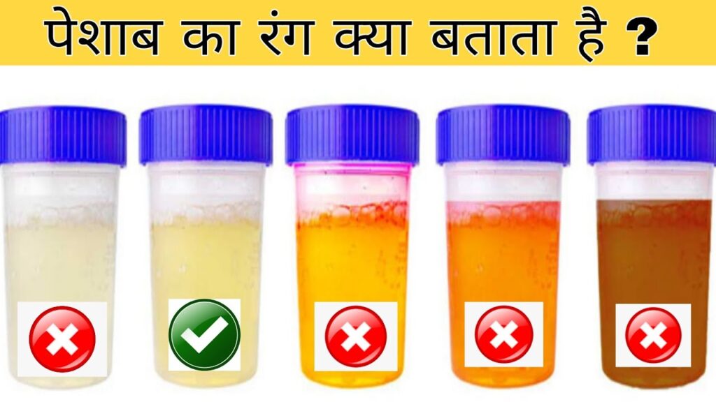क्या आप जानते हैं? पेशाब का रंग करता है शरीर में पनप रही है बीमारियों से सतर्क, जानिए कैसे??